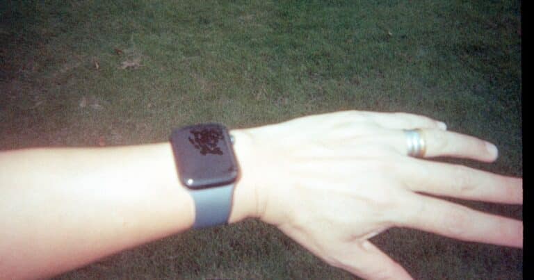 akıllı saat kordonu alerji